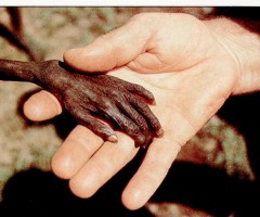 Africa Unicef_bimbi_rischiano_di_morire_di_fame