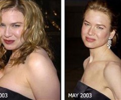 renee zellweger grassa