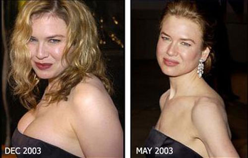 renee zellweger grassa