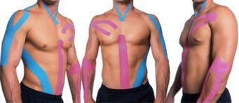 kinesio taping