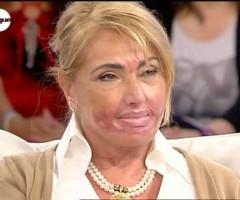 video-sfigurata-mediaset