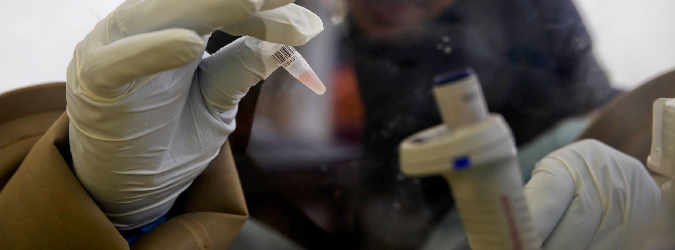 Test negativo per virus ebola