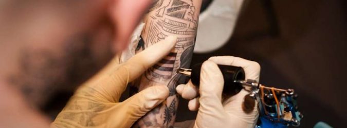 come rimuovere tatuaggio