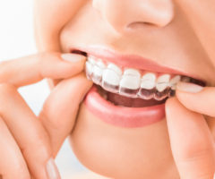 bite per denti