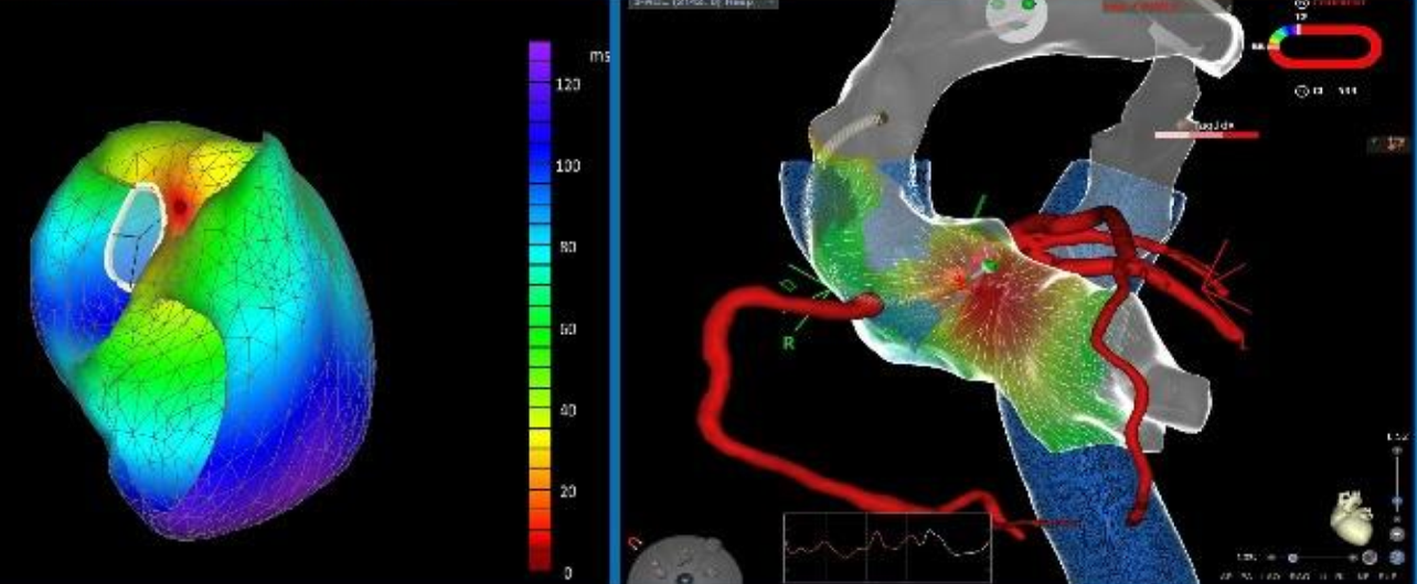 ricerca cardiologia mazzoni