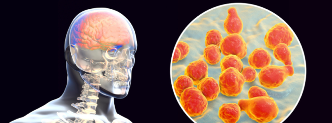 Meningite tubercolare