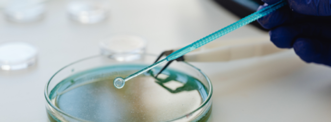 Super batterio di 5mila anni