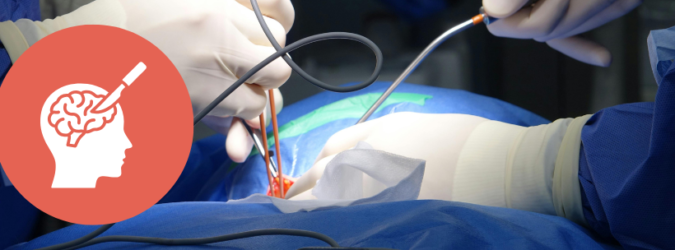 intervento di neurochirurgia