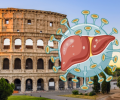 Epatite A Roma