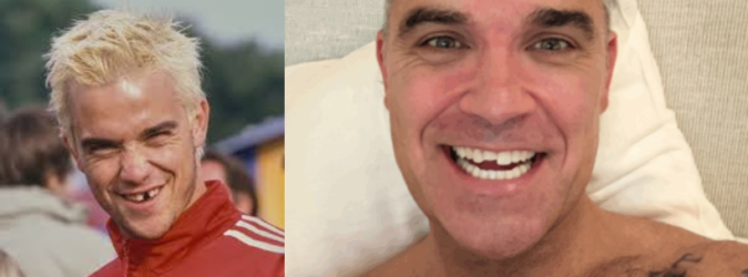 Robbie Williams