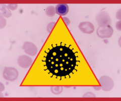 Epidemia di ciclosporiasi negli Stati Uniti