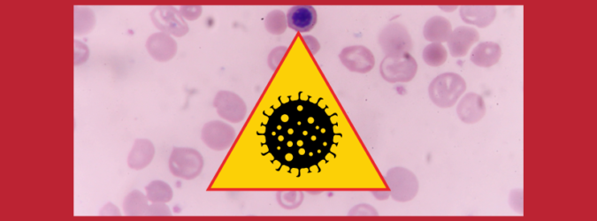 Epidemia di ciclosporiasi negli Stati Uniti