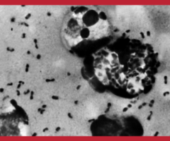 peste polmonare, Siberia, Irkutsk, Russia, Yersinia pestis, OMS, ECDC, malattie infettive, biosicurezza, salute