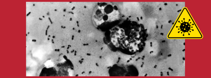 peste polmonare, Siberia, Irkutsk, Russia, Yersinia pestis, OMS, ECDC, malattie infettive, biosicurezza, salute